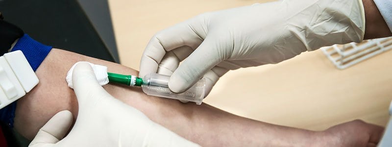 Лихорадка Обработка помещения после лихорадки